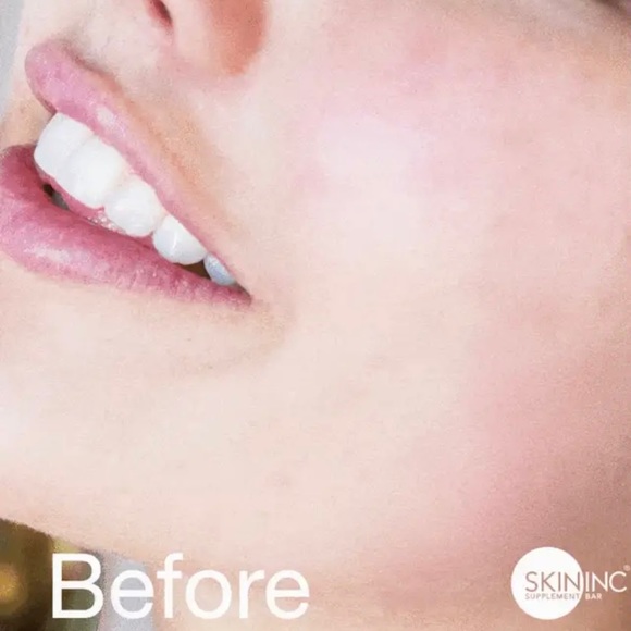 SKIN INC. | Serum Glow Filter hydra micro capsule - Picture 8 of 10